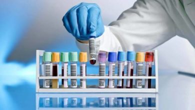 Photo of Des laboratoires privés autorisés à pratiquer les tests du covid19